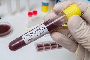 На каких поверхностях коронавирус держится дольше всего?