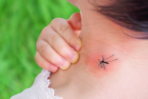 Как защитить себя от укусов комаров на даче?