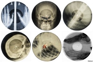 Как в 60-е годы записывали пластинки на рентгеновских дисках?