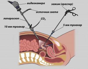 Можно ли удалить кисту кошки, ультразвуком?