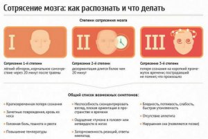 Что будет человеку, из-за которого я получил сотрясение мозга?