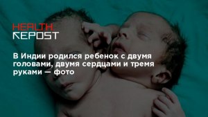 Что влияет на рождение детей с двумя головами?