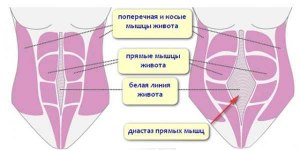 Диастаз после беременности, как его лечить? К какому врачу обратиться?