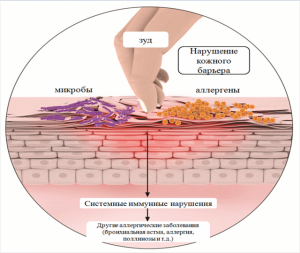 Можно ли симптомы считать подозрением на пневмонию?