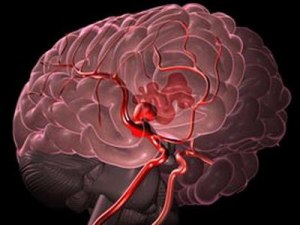Кровоснабжение мозга и кровоизлияние в мозг: в чём разница?