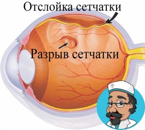 У мужчины 1976 года диагноз отслоение сетчатки глаз, как можно помочь?