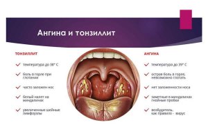 Какие симптомы у заболевшего прогерией?