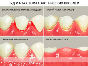 Почему чешутся зубы и на что это указывает? Нужно ли что-то делать?