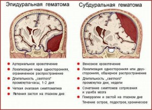 В чём причина появления гематом в мозгу, если не было травм?