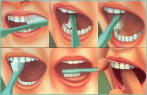 Как часто надо чистить съёмные зубы?