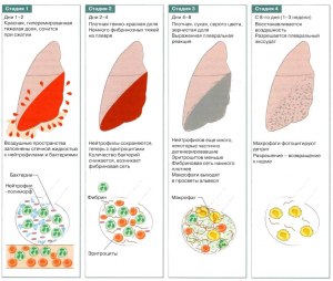 Какие растения могут прорастать в легких человека в при вдыхании семян?