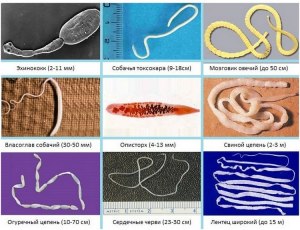 Какие признаки появления в организме человека паразитов и глистов?