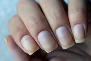 Почему ногтевая пластина начала изгибаться?