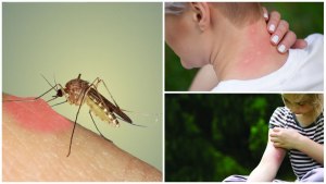 Почему от укуса комара появляются синяки?