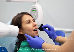 Можно ли делать прицельный рентгеновский снимок зуба при беременности?