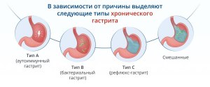 Можно ли при гастрите делать замасливание?