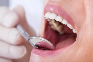 Зачем стоматолог оставляет дырку в зубе на некоторое время?