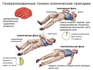 Что делать с большими созревшими прыщами на лице?