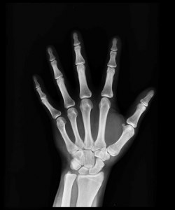 Рентген кисти это направленный или панорамный снимок?