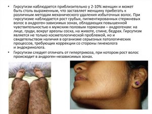 Как лечить гирсутизм?