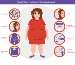 Как лечить гиперандрогению?