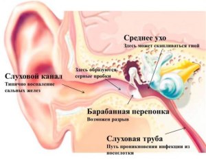 Зачем нам сера в ушах?