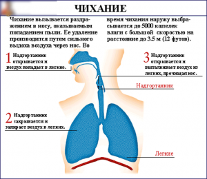 Как определить какого генеза чихание?