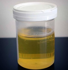 Что означает очень светлая моча у человека?