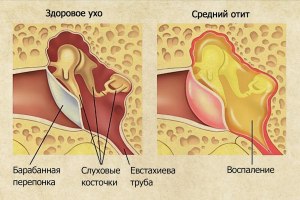 Куда уходит мокрота при глотании?