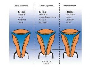 Что такое слизь в гинекологическом мазке? Сколько должно быть в норме?