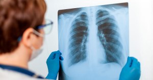 Правда ли, что после вдыхания корицы могут появиться дырки в лёгких почему?
