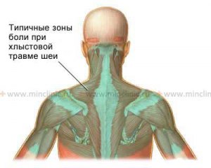 Почему травмы шеи смертельно опасны?