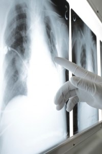 Как самому качественно оцифровать рентгеновские снимки?