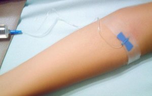 Как можно сделать синяк при внутривенной инъекции?