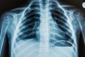 Примет ли врач рентген снимок, сделанный в другой больнице?