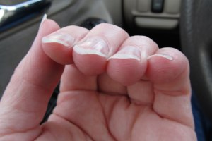 Почему маленькие ногти на ногах растут быстрее большого (на боль-м пальце)?