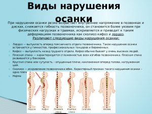 Что же такое "звенит" в позвонках?